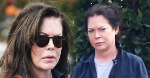 //lara flynn boyle puffy face pp