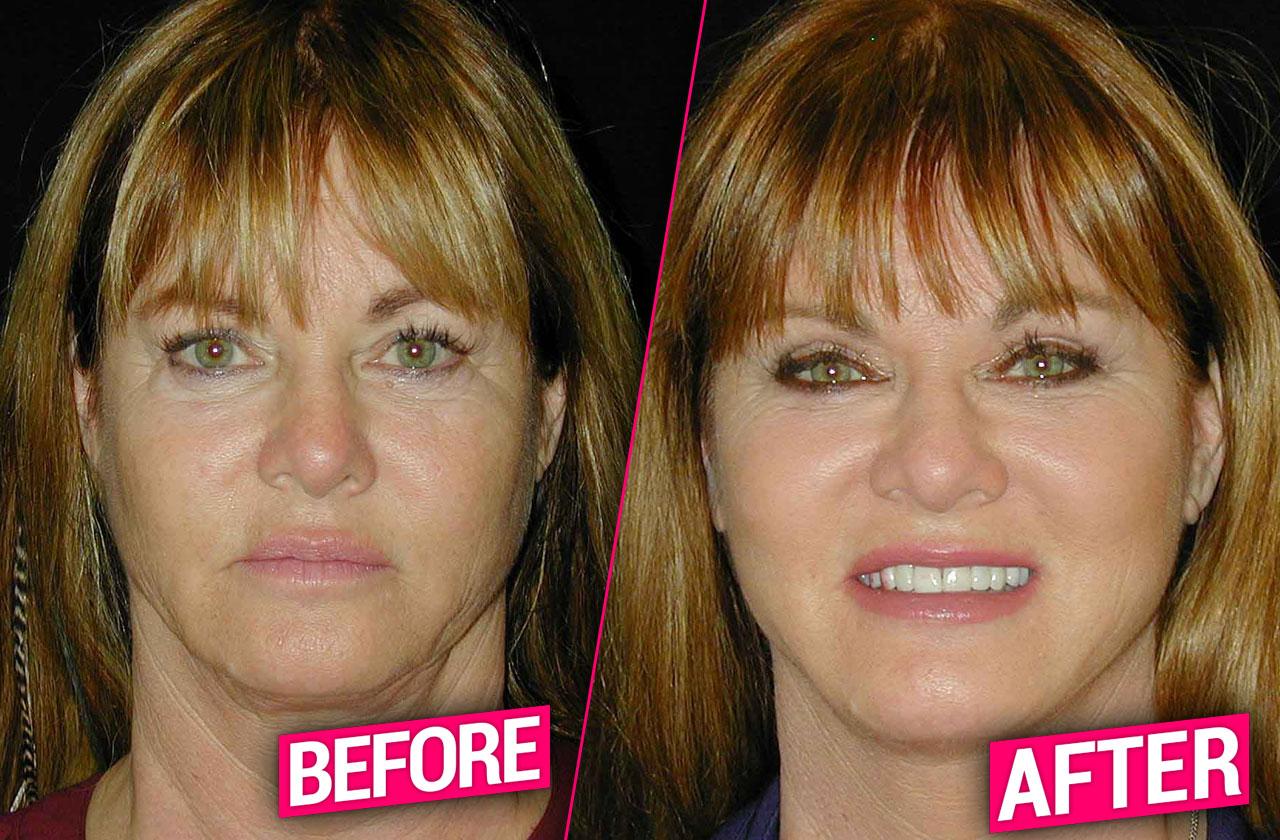 //rhoc Jeana Keough plastic surgery makeover pp