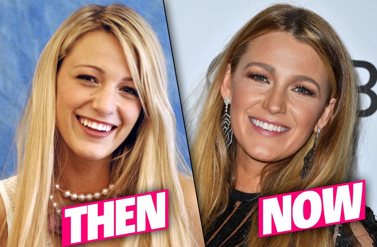 Blake Livelys Nose Job Rumors Secret High Babe Photos Uncovered