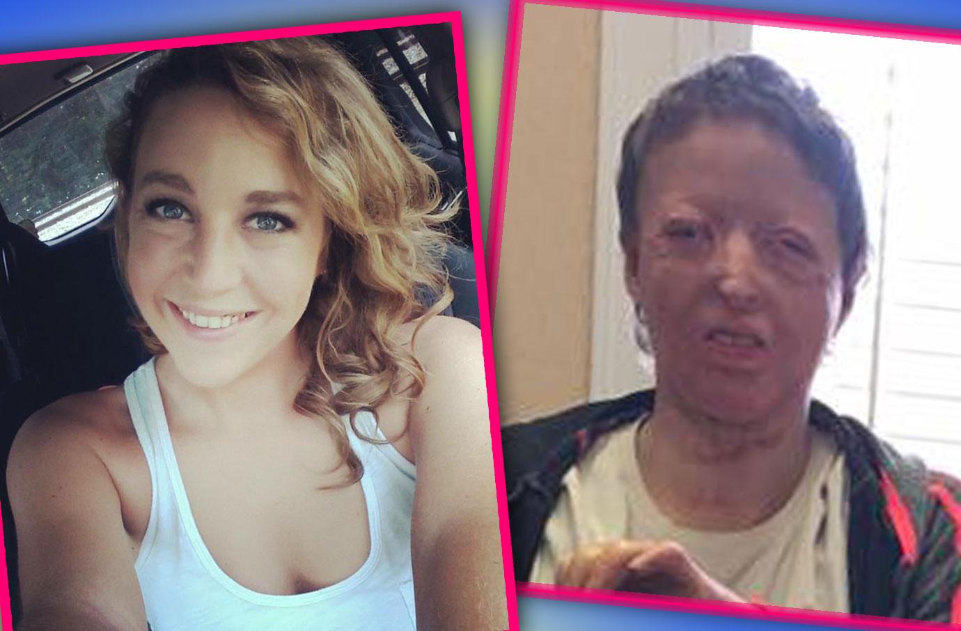 [PHOTOS] Burn Victim Mom Courtney Waldon Finds Love After Heartbreak