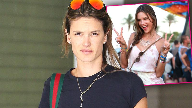 //alessandra ambrosio medical procedure headaches coachella pp