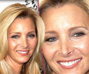 //lisa kudrow nose job ugly tall
