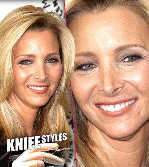 //lisa kudrow nose job ugly tall