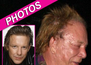 //mickey rourke plastic surgery