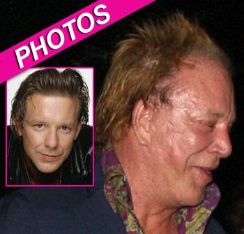 //mickey rourke plastic surgery