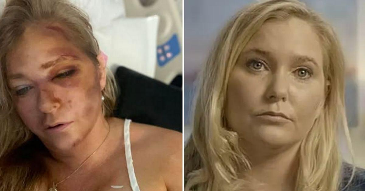 Virginia Giuffre's Death Mystery Unravels: Jeffrey Epstein and Prince Andrew's Accuser 'Was Already Dead' In The Chilling Photo of Her Bruised Face as Disturbing New Theories Emerge