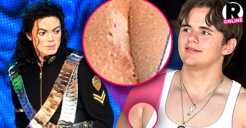 //prince jackson michael dealing skin condition vitiligo pp sl