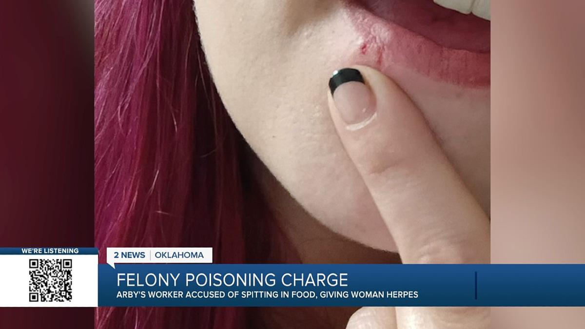 Jennica Church said the manager had herpes, and knowingly gave the infection to her. 