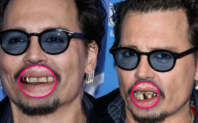 Former Sex Symbol Johnny Depp Spotted With Yellow Teeth   Johnny Depp Yellow Teeth Photos Drug Abuse Spiral Pp 4 