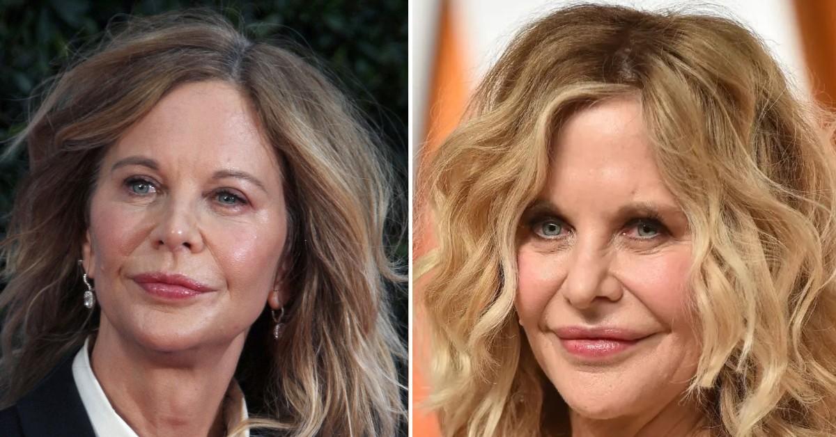 meg ryan addicted plastic surgery pp