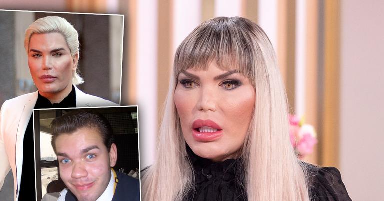 Human Ken Doll Rodrigo Alves Considered Suicide Before Transition