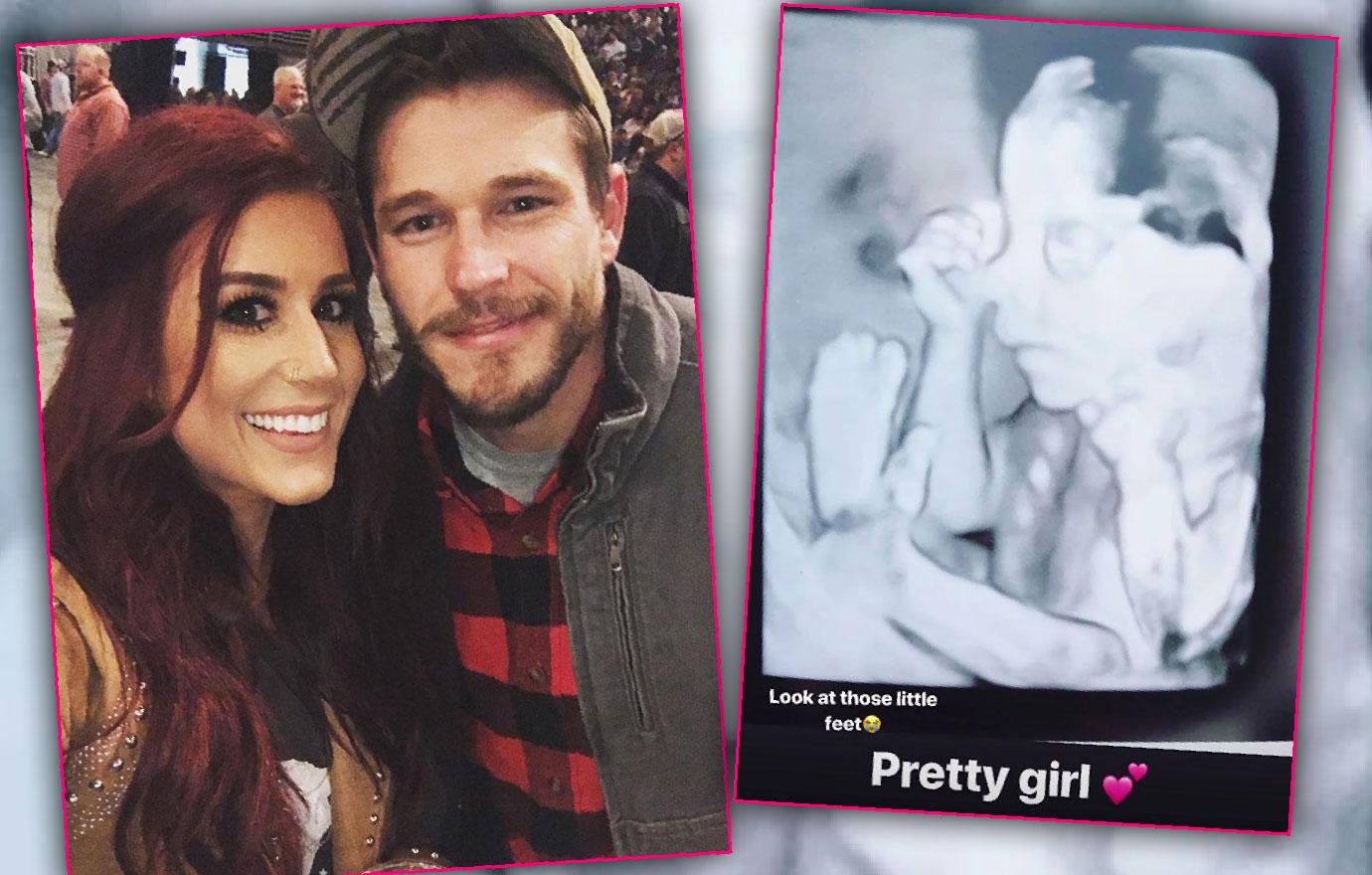 Chelsea Houska Posts Ultrasound Baby Pic After Adam Lind Scandal