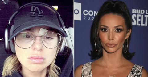 raquel scheana bruise pp