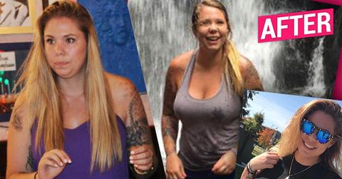 kailyn lowry breast augmentation