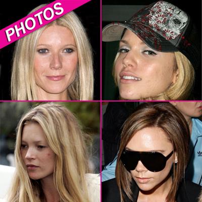 //celeb acne kate moss victoria beckham wennzuma