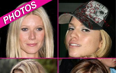 //celeb acne kate moss victoria beckham wennzuma