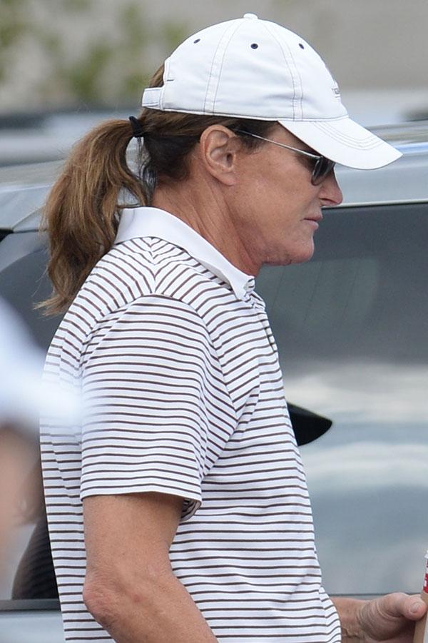 //bruce jenner sex change spent  transition hair botox fillers