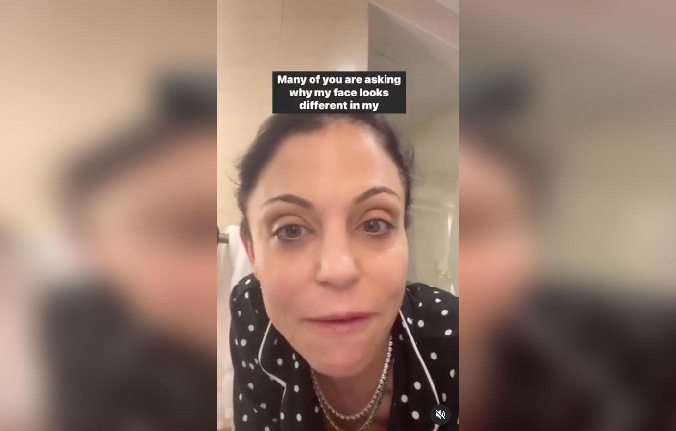 Ex-‘RHONY’ Star Bethenny Frankel Reveals Autoimmune Disease Struggles ...