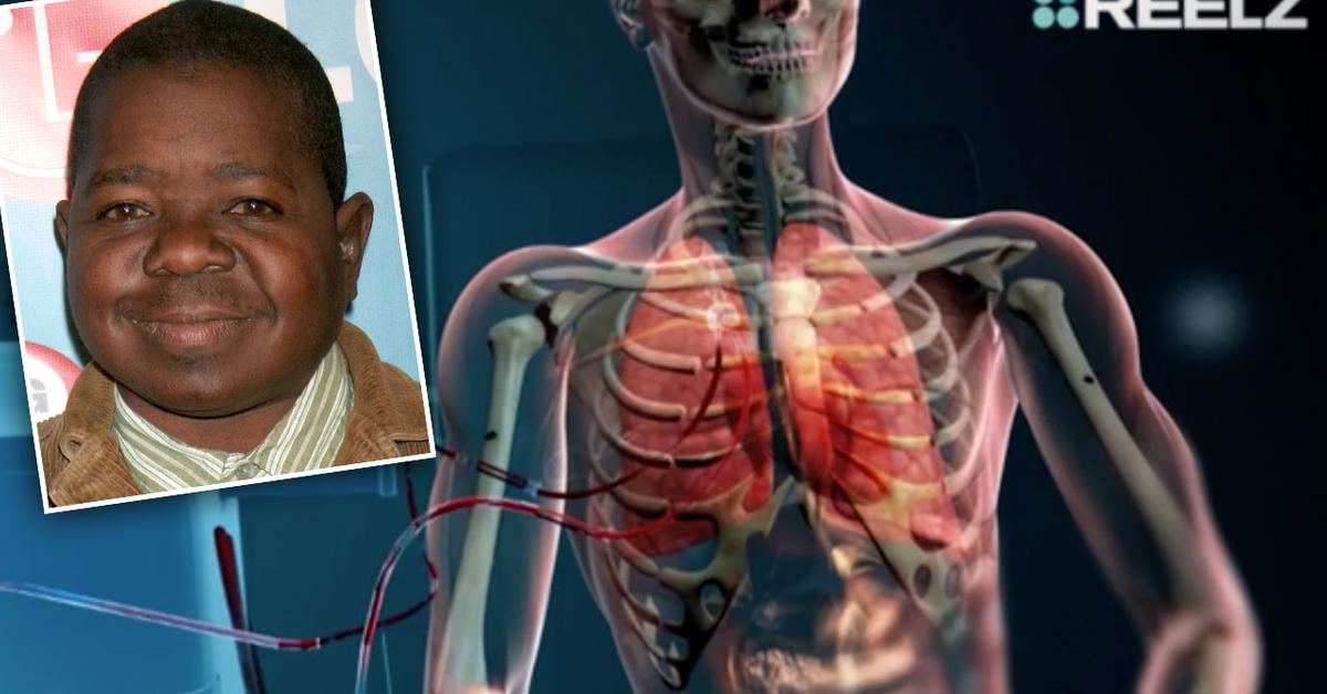 ‘Autopsy’ Reveals Evidence Behind Gary Coleman’s Tragic Death