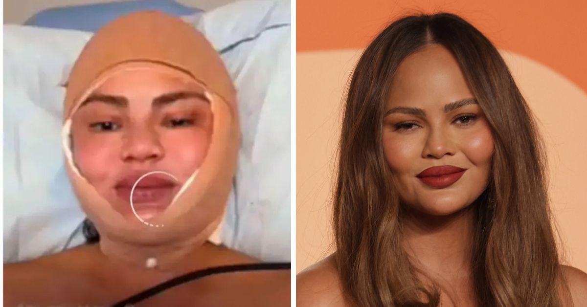 Photo of Chrissy Teigen