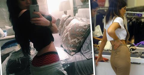 Kylie Jenner Butt Injections