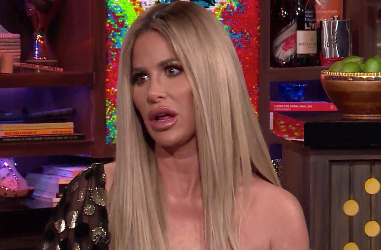 kim zolciak son kash biermann dog bite health update wwhl