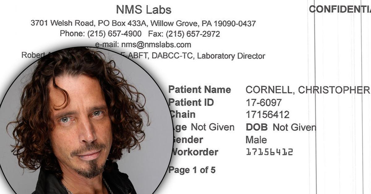 Chris Cornell Suicide Toxicology Report Shows Drugs & ‘Evidence Of