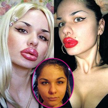 Lip Service: Woman Undergoes 100 Silicone Injections To Look Like Jessica  Rabbit