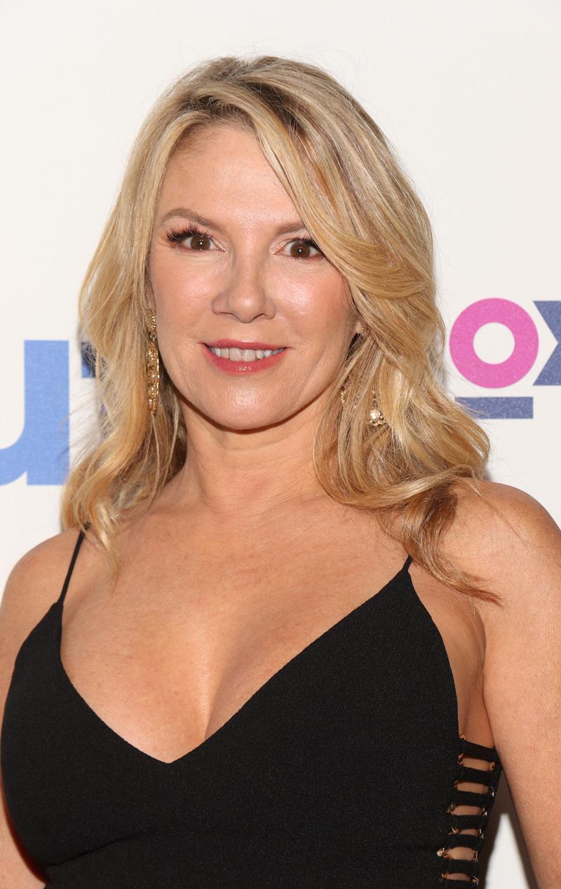 Ramona Singer Plastic Surgery RHONY