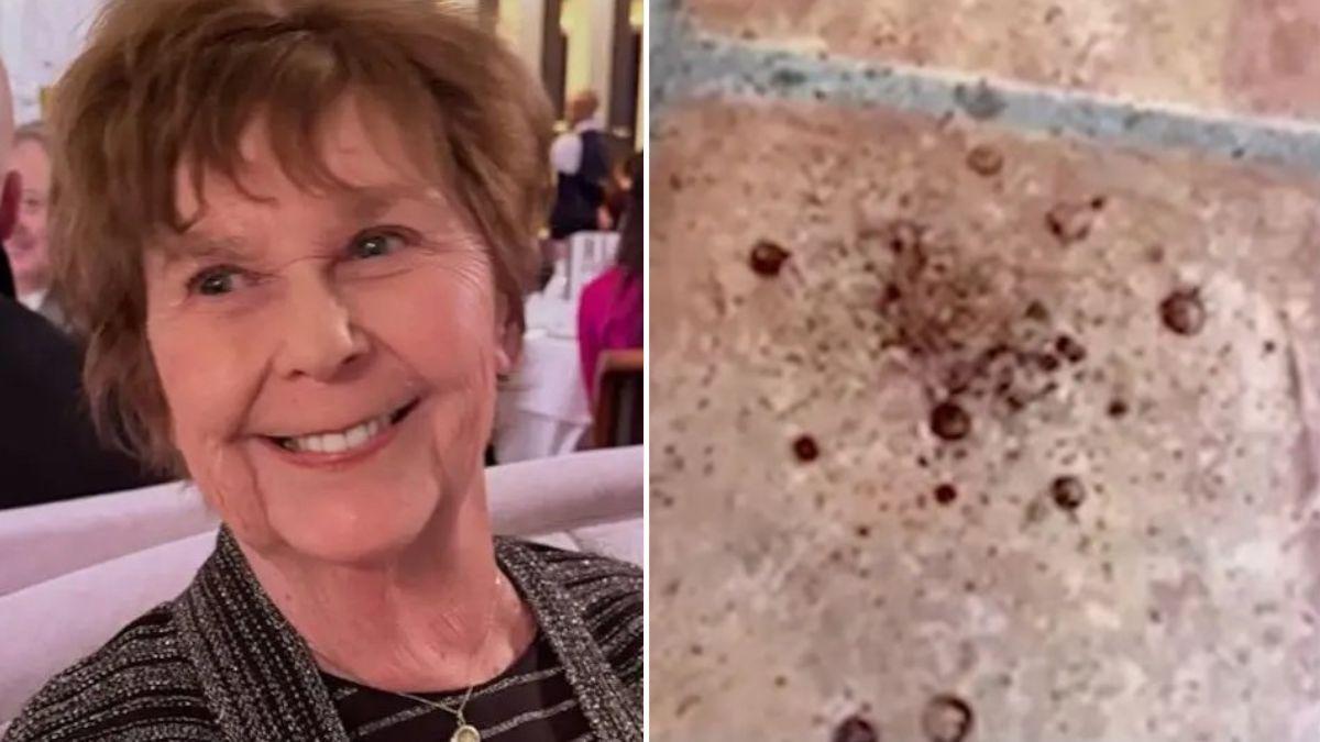 Evidence indicates Nancy Guthrie was injured when she was taken from her home.