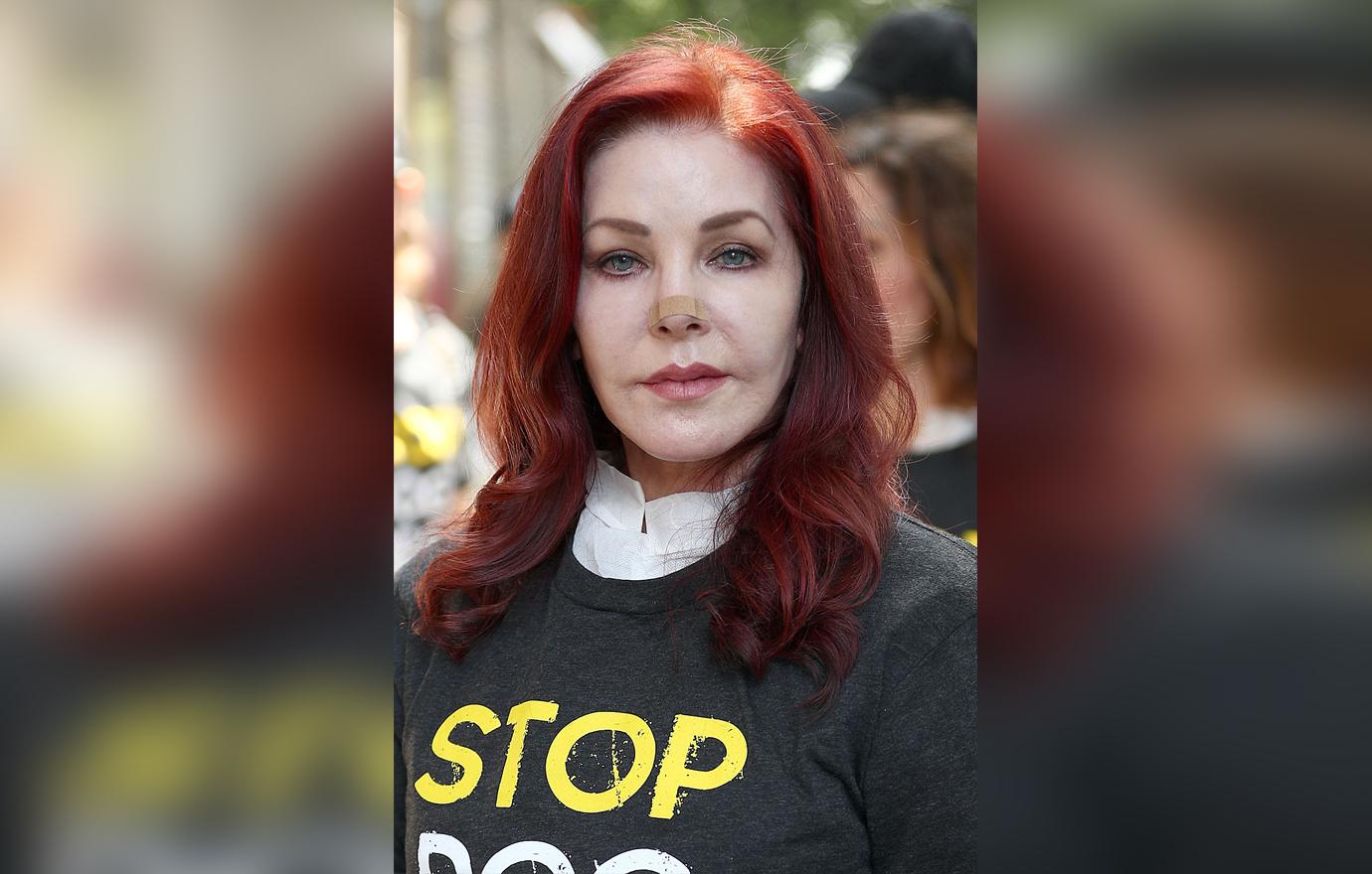 Priscilla Presley Skin Cancer Surgery