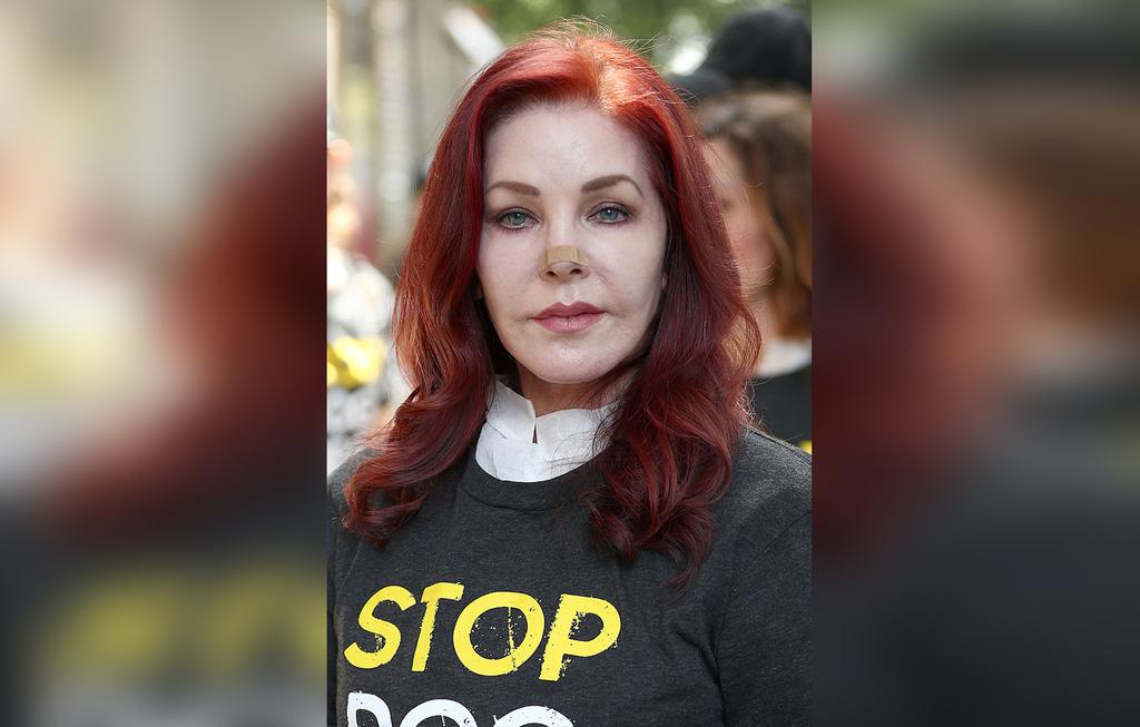 Priscilla Presley Ruins Looks After Skin Cancer Surgery Drama