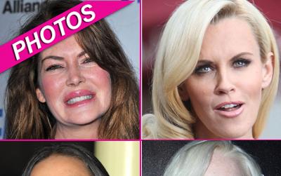 //celeb over botoxed wenn post