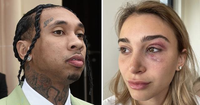 tyga girlfriend abuse claims pp