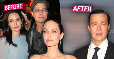 angelina jolie brad pitt plastic surgery botox