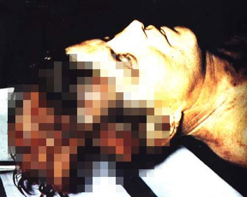 autopsy deaths infamous