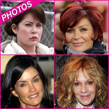 Obsessed With Plastic Surgery! 10 Celebrities Who Can’t Stop Going