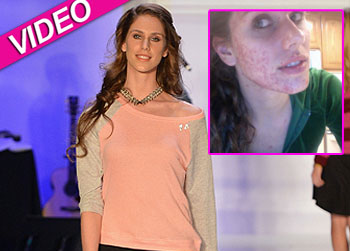 //cassandra bankson acne catwalk getty