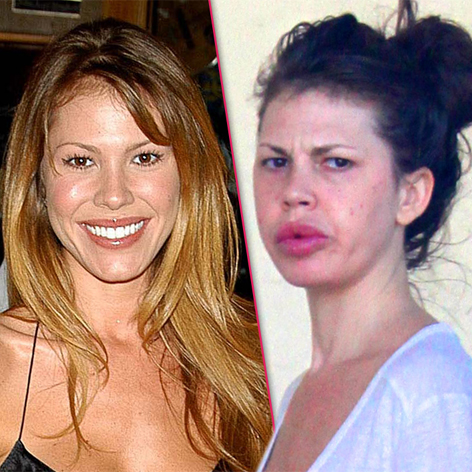 Extreme Trout Pout Alert! What HAS Nikki Cox Done To Her Lips?!?