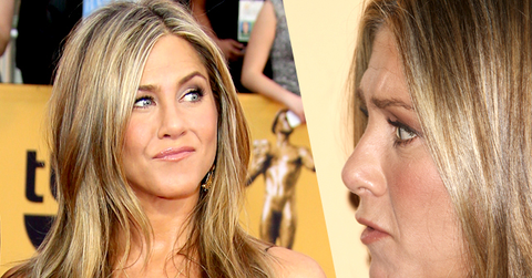 //Jennifer aniston plastic surgery pp