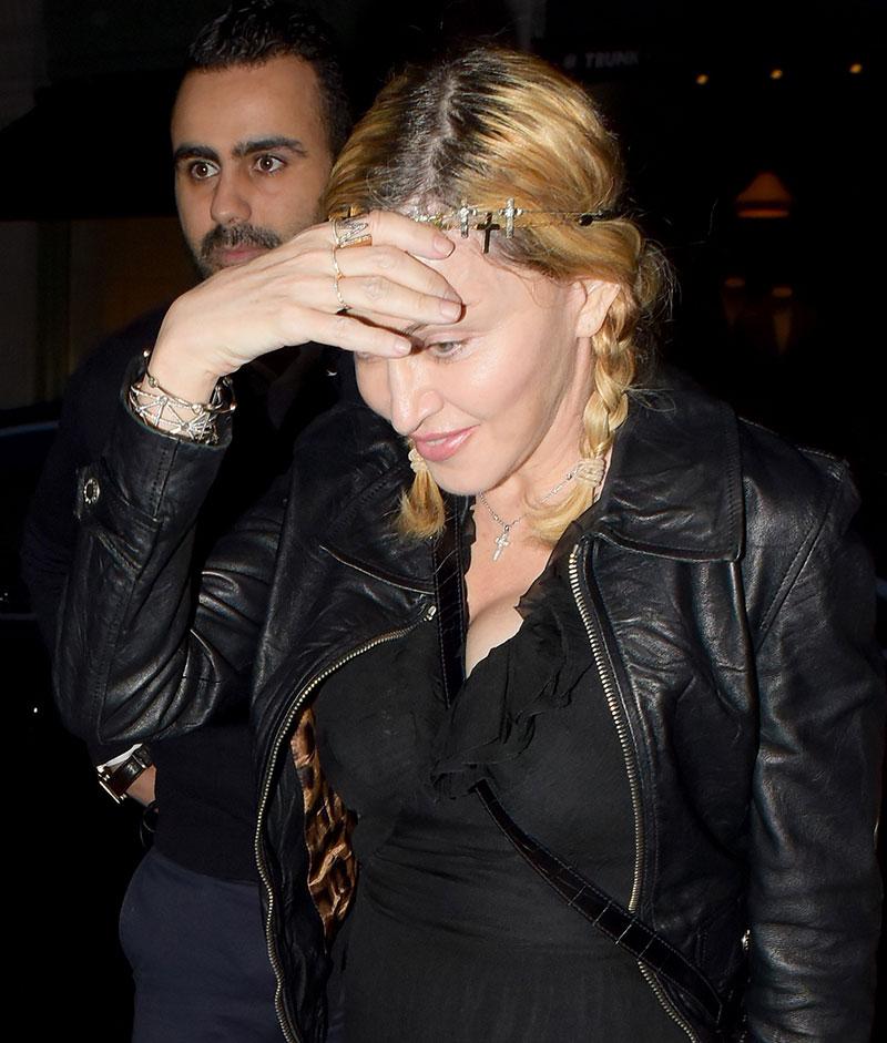 Desperate Measures Madonna Deveined Wrinkly Skin With Drastic Surgery Docs Say 9751