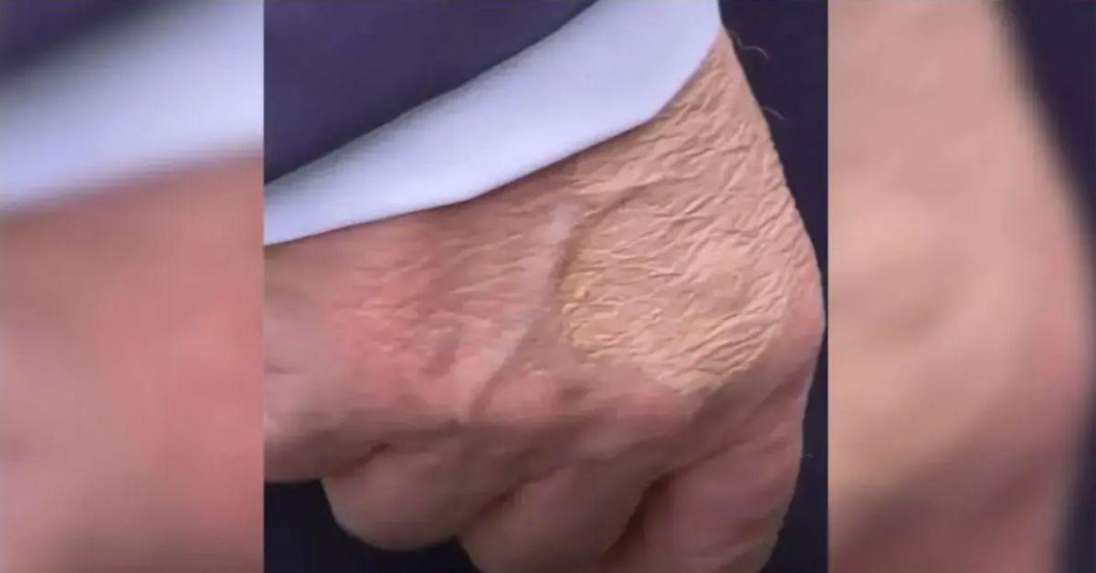 Photo of Donald Trump hand