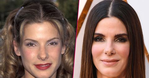 sandra bullock plastic surgery cheek fillers