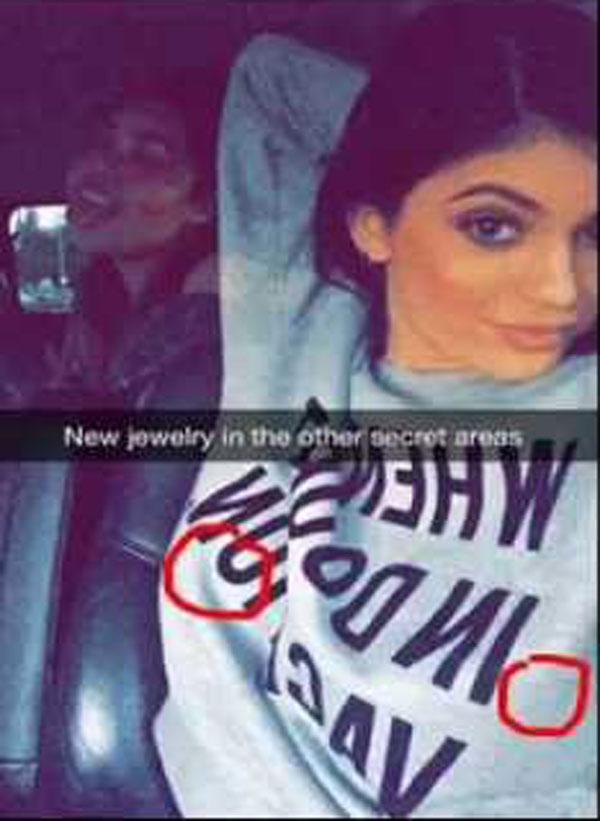 //kylie jenner plastic surgery top doctor estimates boob job face work extensions