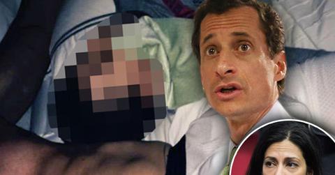 Anthony Weiner Sexting Son Scandal Child Protective Services