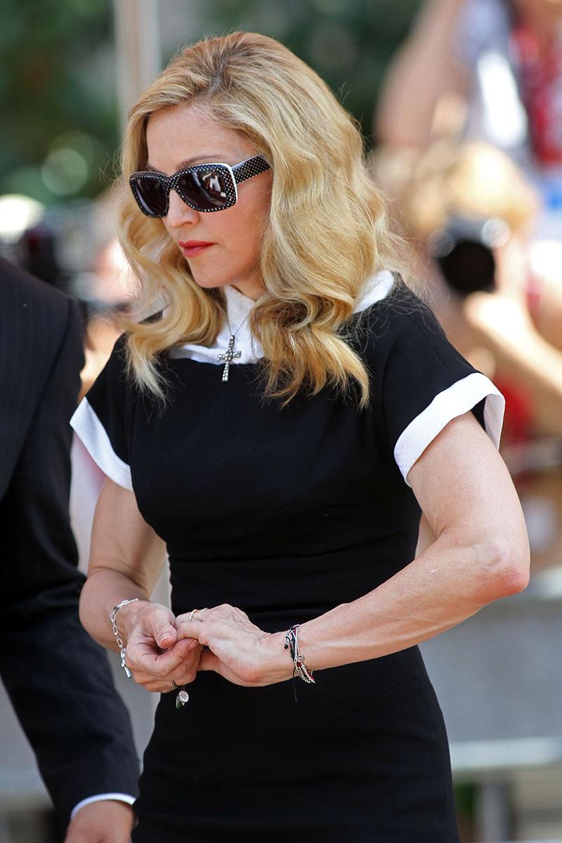 Desperate Measures Madonna Deveined Wrinkly Skin With Drastic Surgery Docs Say 5425