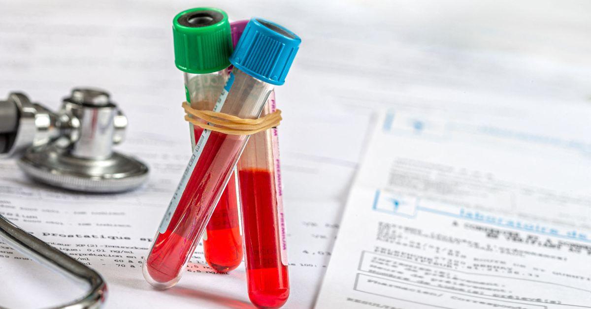 University of North Carolina's Rex Hospital staff were exposed to HIV-tainted blood during the assault.