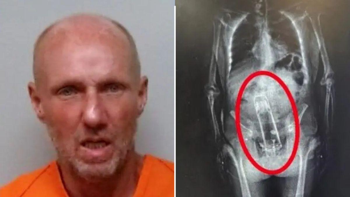 Walter Frymire/x-ray