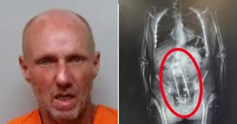 Walter Frymire/x-ray