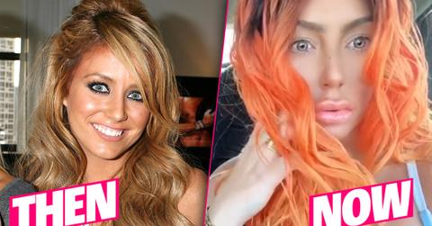 Aubrey O’Day Plastic Surgery